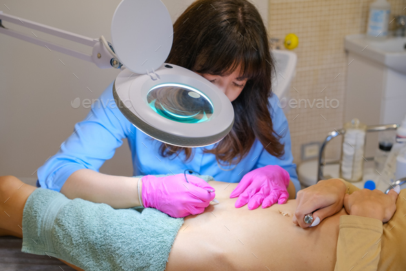 Young woman dermatologist doing hair removal treatment on patient s bikini zone with electrolysis